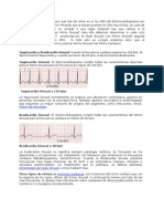 Electrocardiograma