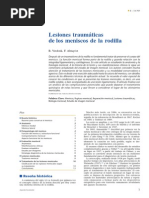 2006 Lesiones Traumáticas de Los Meniscos de La Rodilla