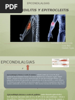 Epicondilitis y Epitrocleitis 