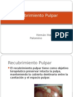 Recubrimiento Pulpar