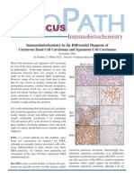 Basal Cell Vs Squamous