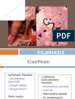 Filariasis