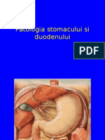 Ulcerulgastric Duodenal