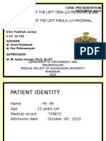 Ulmi Fadillah - Case Report (Open Fracture Tibia Fibula) Revisi 2