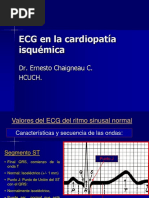 ECG en Cardiopatía Isquémica