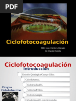 Ciclofotocoagulación