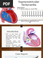 Supraventricular Tachycardia