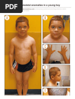 Oligodontia and Skeletal Anomalies in A Young Boy