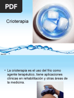 Crioterapia