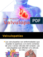 Valvulopatías 3