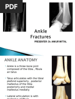 Ankle Fracture