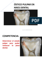 Diagnóstico Pulpar en Caries Dental