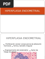 Hiperplasia Endometrial