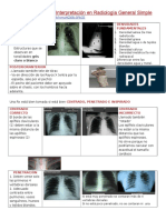 Fundamentos para Interpretación en Radiología General Simple