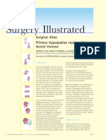 Surgical Atlas Primary Hypospadias Repair With Buccal Mucosa