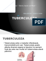 TUBERCULOZA