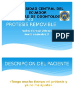 Caso Clínico Protesis Removible