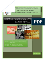 Interpretacion Radiografica de La Caries Dental