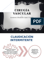 Claudicación Intermitente