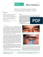 Ocular Prosthesis