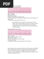 Normal Sinus Rhythm