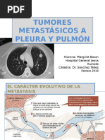 5.tumores Metasásicos Pleura Pulmón