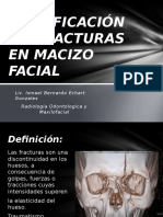 Clasificación de Fracturas en Macizo Facial