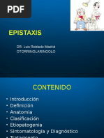 Epistaxis