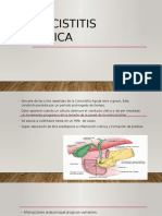 Colecistitis Crónica