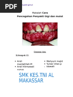 Makalah Pencegahan Peny - Gimul