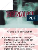 Apresentação Tuberculose