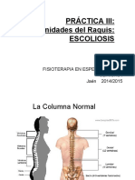 Escoliosis (I)