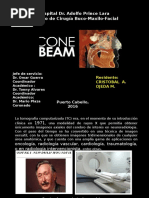 Cone Beam