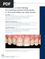 Infiltration, A New Therapy For Masking Enamel White Spot PDF