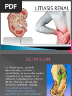 Litiasis Renal Signos y Sintomas Diagnostico TX Prevencion