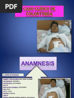 Caso Clinico Colostomia