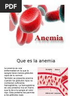 Anemia