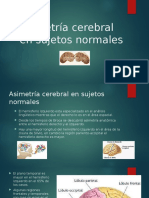 Asimetría Cerebral en Sujetos Normales