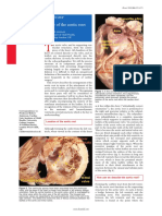 Clinical Anatomy of The Aortic Root