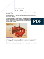 Colelitiasis