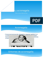 Gigantismo y Acromegalia