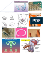 IUD Combined Oral Cotraceptive Pill