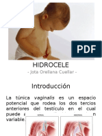 HIDROCELE