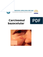 Carcinomul Bazocelular