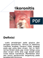 Perikoronitis