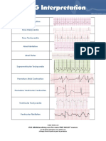 10 Ecg Heart Rhythms PDF