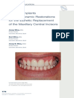 Zirconia Implants and All-Ceramic Restorations For The Esthetic Replacement of The Maxillary Central Incisors