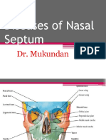 Deviated Nasal Septum 2