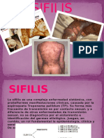 SIFILIS