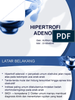 Hipertrofi Adenoid